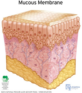 Mucosal membrane pressure injury