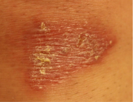 Forensic examination close-up photo of a patient injury