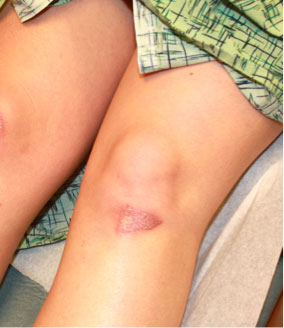 Forensic examination medium-range photo of a patient injury